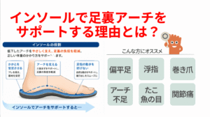 インソールで足裏アーチをサポートする理由